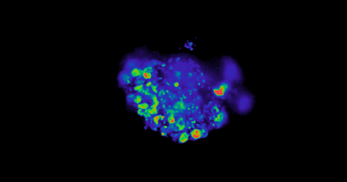 β-cell maturity